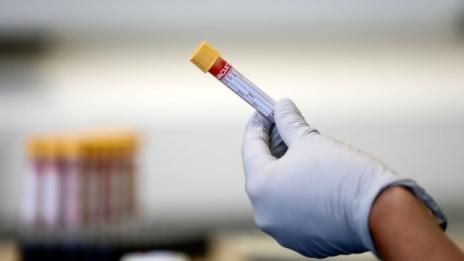 Влизаме в Турция без PCR, ако сме ваксинирани 
