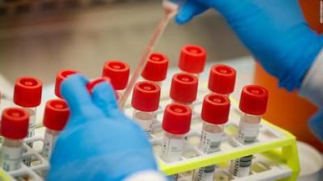 58 са новите случаи на COVID-19 у нас за последното денонощие