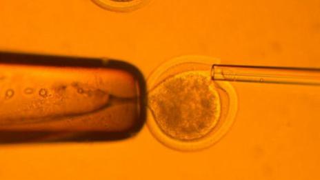 Учени използваха спорна технология за редактиране на човешки ембриони