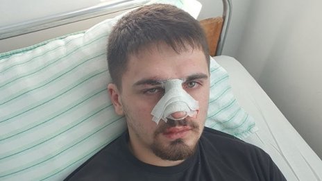 Баща проплака с пост: Четирима полицаи пребиха сина ми като куче!