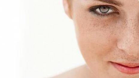 5 природни метода срещу тъмни пигментни петна