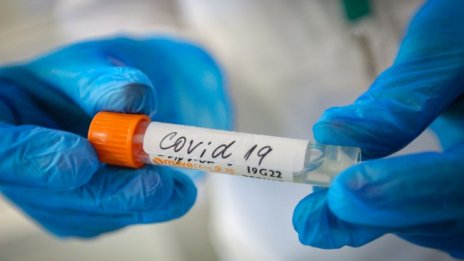 Черният списък на МЗ: COVID-19 отне живота на 37-годишна здрава жена