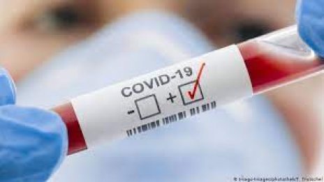 Продължават да растат случаите на COVID у нас