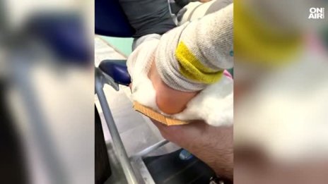 Скандално: Направиха шина за счупен крак на дете от картонена кутия за пица