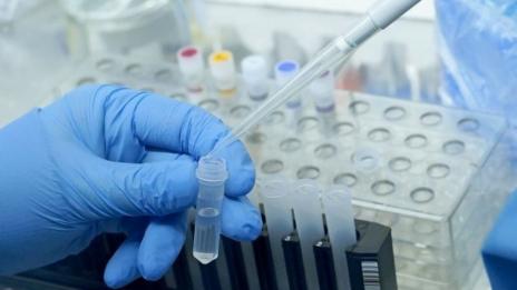 Двете заразени с коронавирус от Габрово не са имали контакт