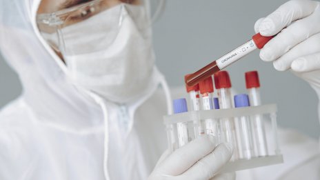 Расте броят на случаите на валицела и скарлатина във Варна