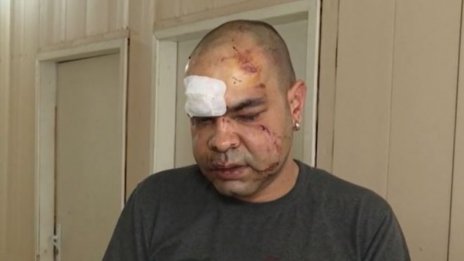 Пребитият медик останал без зъби