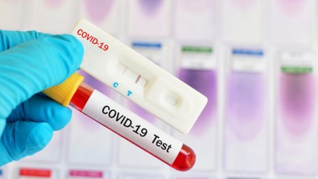 Варна на 13 ковид случая зад София. За ден 34-ма българи загубиха живота си