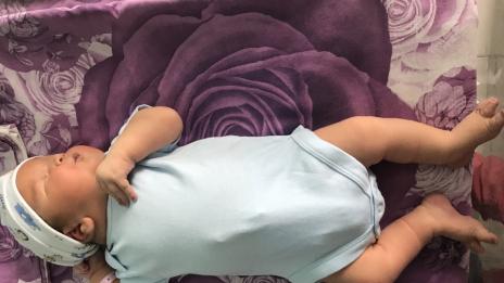 Бебе гигант се роди в АГ-то във Варна