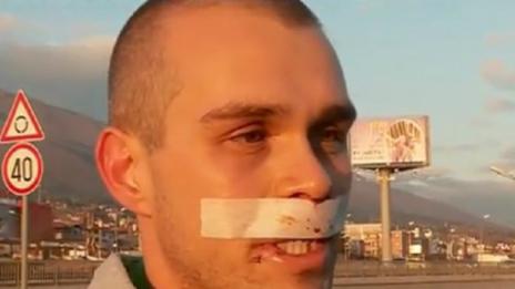 Битият на Околовръстното – без 3 зъба, жена му също ранена