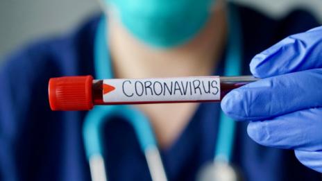 Мъжът с положителна проба за COVID-19 от Плевен е добре  