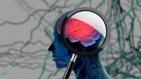 Безплатни тестове за ранни признаци на деменция и Алцхаймер във Варна