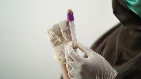 В Румъния регистрираха първи случай на маймунска шарка