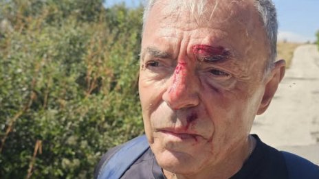 Бивш министър се претрепа с колело заради дупка на пътя (ВИДЕО)
