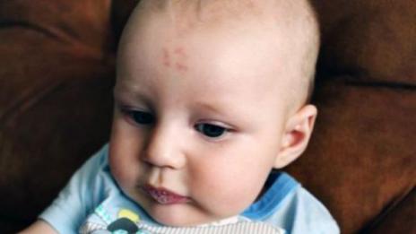 Бебе се роди с 12 на челото