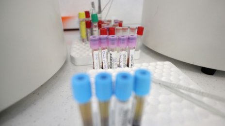 79 са новите случаи на COVID