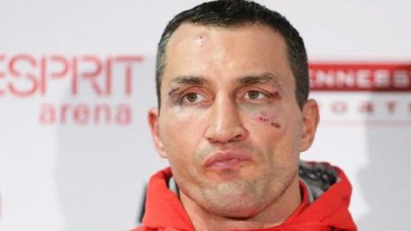Кличко: Сърцето ми е в покой, като предавам щафетата на Джошуа