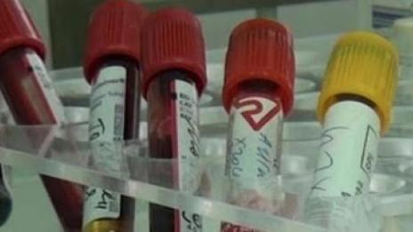 Коронавирусът не бил продукт на генно инженерство