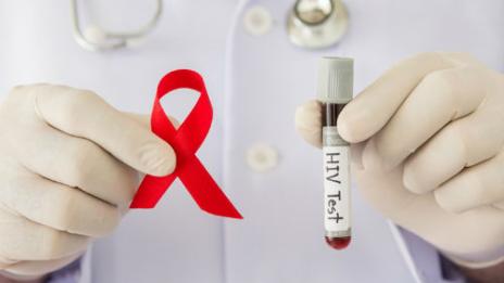 По официална статистика 2383 българи живеят с вируса на ХИВ