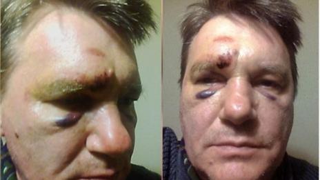 Преподавател във ВУЗ – жертва на полицейско насилие