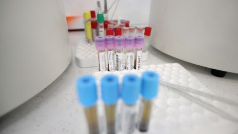 32 са новите случаи на COVID у нас за последното денонощие