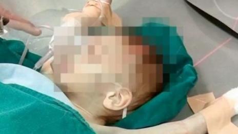 Пуснаха майката на недохранените близнаци, те – в болница