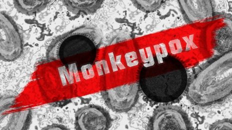 Маймунската шарка взе 2 жертви