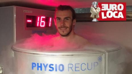 Гарет Бейл се възстановява на - 161°С