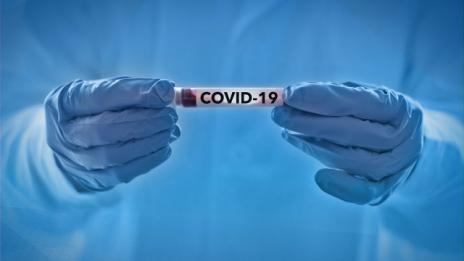 Пациентът с COVID-19 в Инфекциозна клиника-Пловдив се върнал от Англия