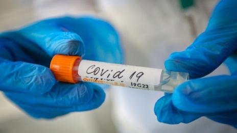 Утре изписват първите трима, оздравели от COVID-19 във Варна
