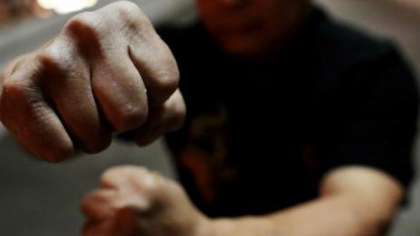 Ад по Коледа: След жесток побой вкъщи – три пенсионерки ослепяха
