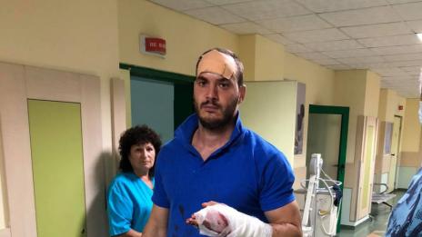 Ромска вендета в Роман – яростно съсякоха с мачете охранител