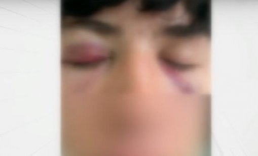 При спор за цигара: Дете е в болница след побой от младеж