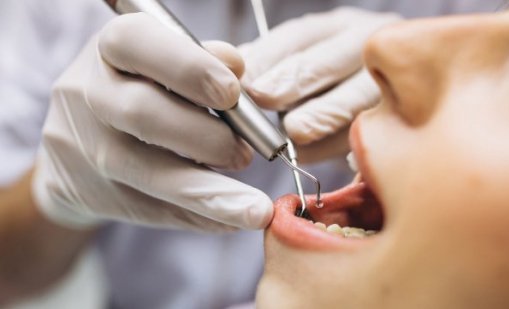 Зъболекарят стана лукс: Почти двойно поскъпване на стоматологичните услуги у нас