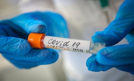Увеличават се случаите на COVID във Варна