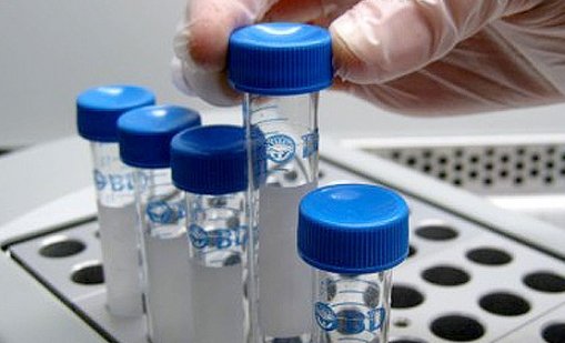 Ужас! Сперма, предаваща генетично рак, е използвана за зачеването на почти 200 деца в Европа