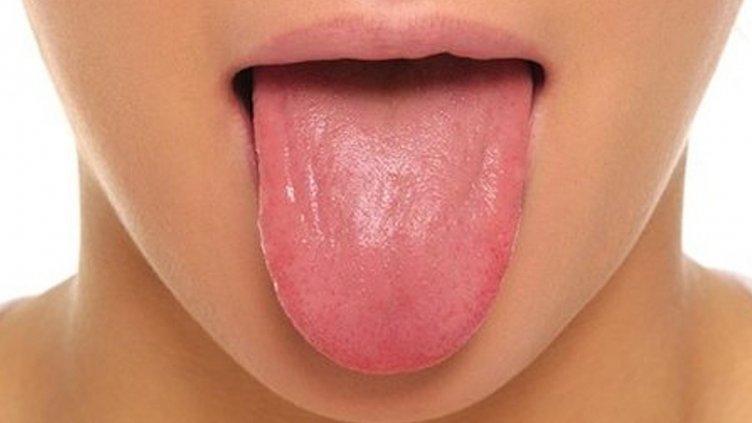 Езикът се подува, ако имаме COVID-19