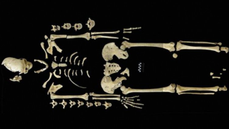 Левкемията е съществувала и преди 7000 г.