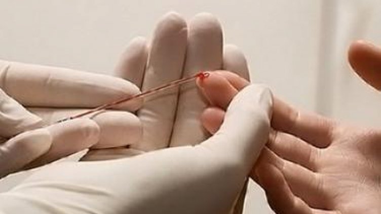 Световен ден за борба с хепатита отбелязваме днес