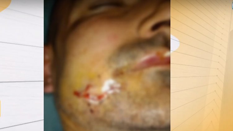 Двама мъже са пребити заради направена забележка за шум