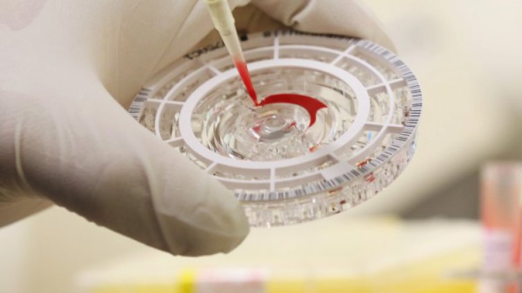 Учени: Ракът се дължи на лош късмет