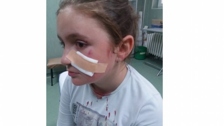 Нараненото момиче. Снимка фейсбук.