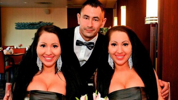 Еднояйчни близначки раждат заедно от общото си гадже