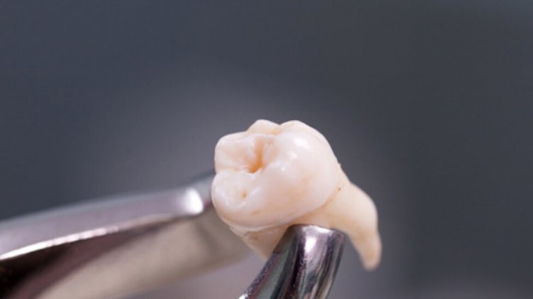 Искате по-добри вкусови рецептори? Махайте мъдреците!