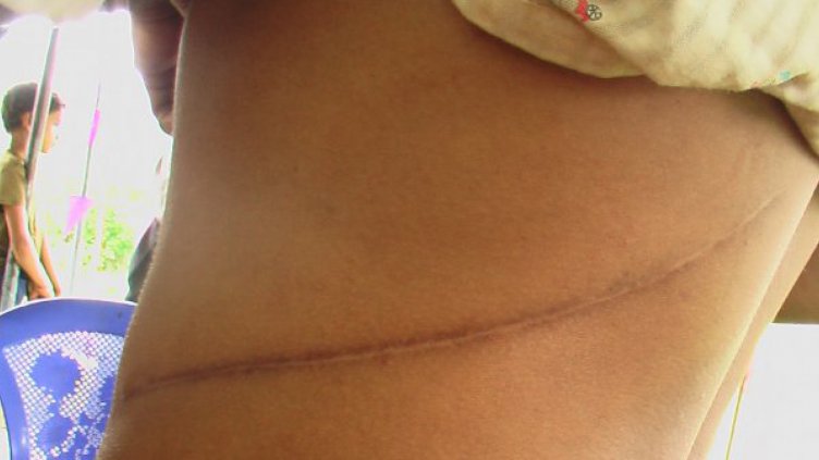 В Турция задържаха израелтянин за търговия с човешки органи