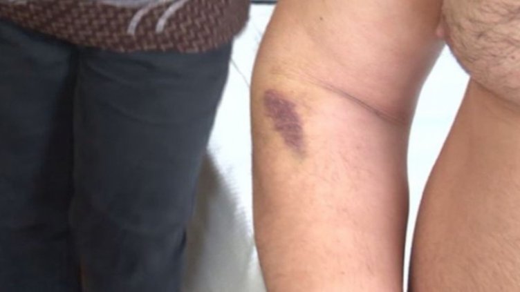 МВР проверява обвинения на майка и син за полицейски тормоз в Плевен