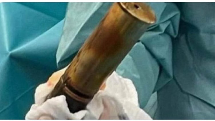 Евакуираха болница заради 88-годишен със снаряд в ректума (СНИМКА)