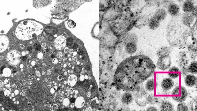 И нямат край, нашир и длъж: Новият Омикрон 2, ваксината не го лови