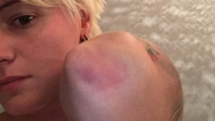 Пребиха певицата Рут Колева (Снимки)