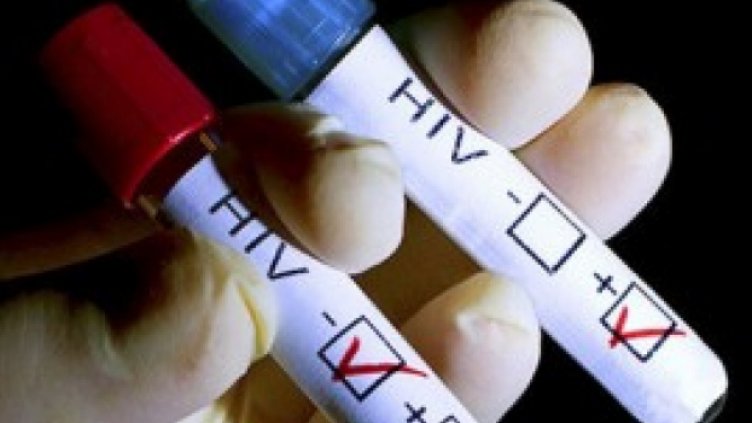Учени съобщиха за революционен напредък в борбата с ХИВ